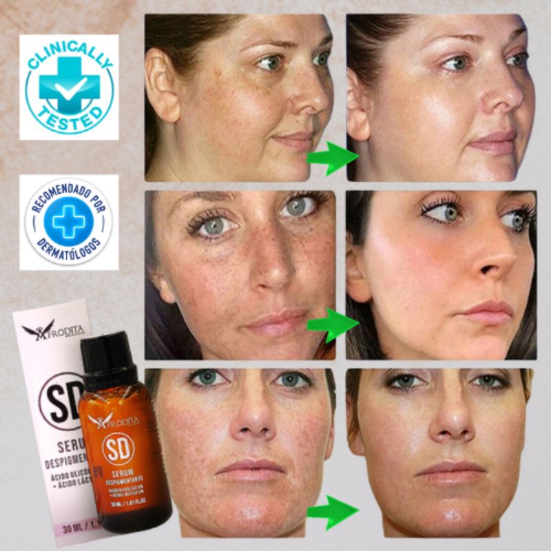 Serum Quita Manchas Afrodita SD™