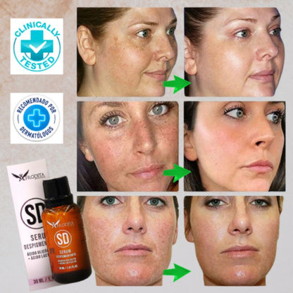 Serum Quita Manchas Afrodita SD™